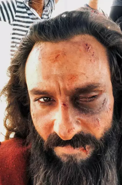saif ali khan injury stabbing
